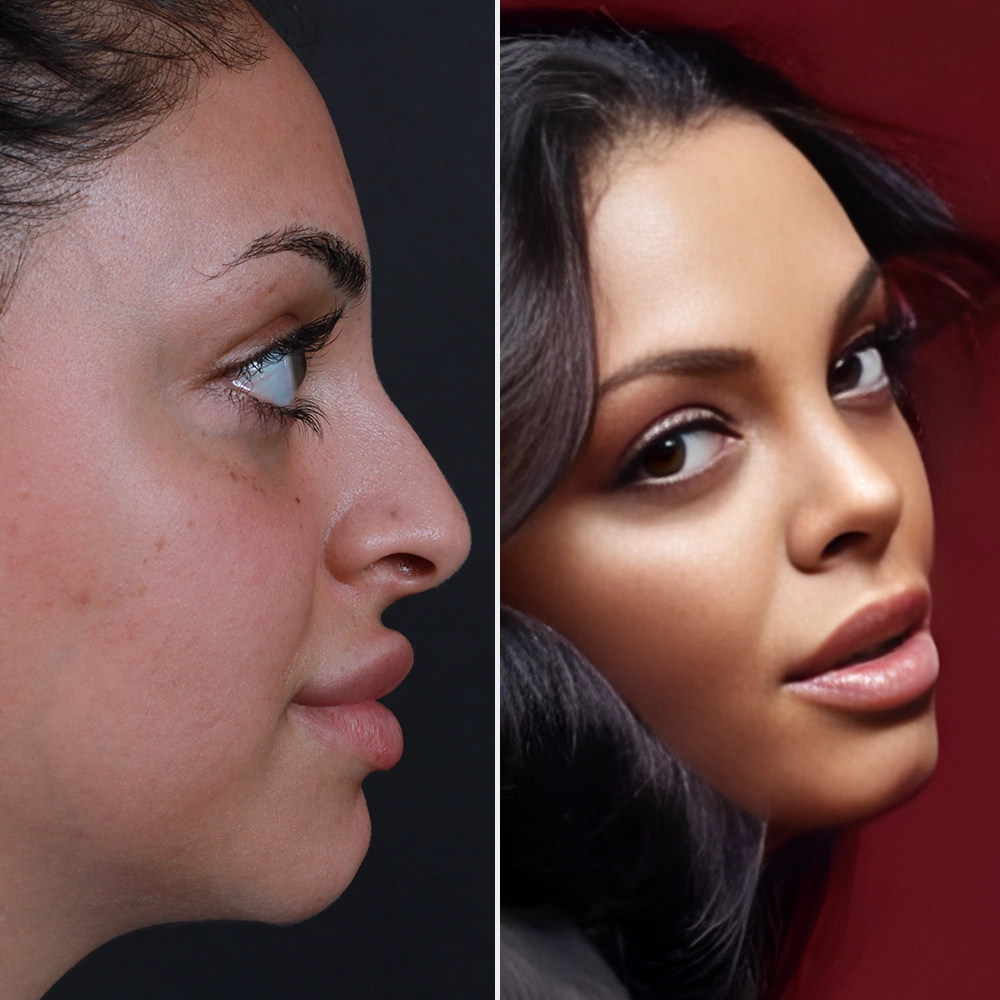 Before and After